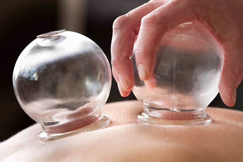 Shi4Balance cupping